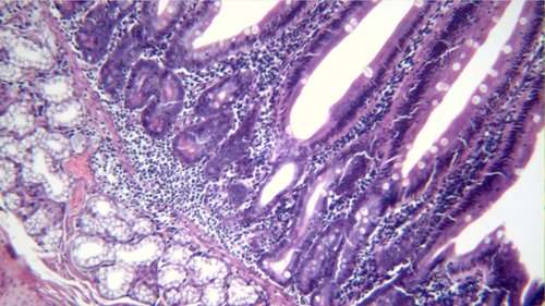 Compound Microscope Tips Maximizing Your Compound Microscope - Tips and Tricks