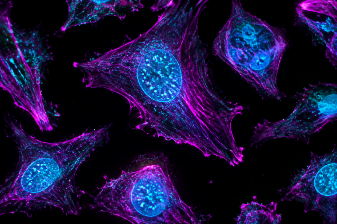 How to Choose a Compound Microscope for Cell Observation