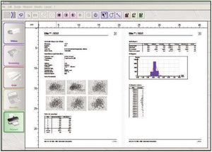 Ellix Image Analysis Software for Fully Automatic Particle Size and Shape Analysis