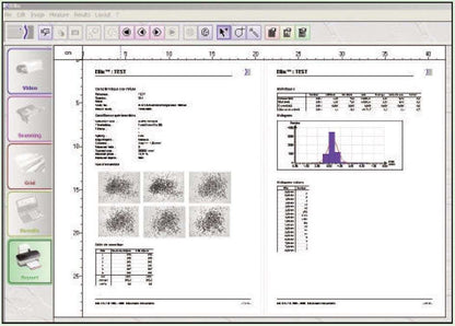 Ellix Image Analysis Software for Fully Automatic Particle Size and Shape Analysis