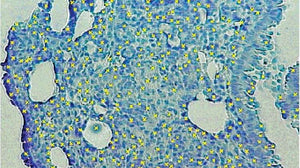 HistoLab Image Analysis Software for Fully Automatic Feature Size, Shape and Colour Analysis