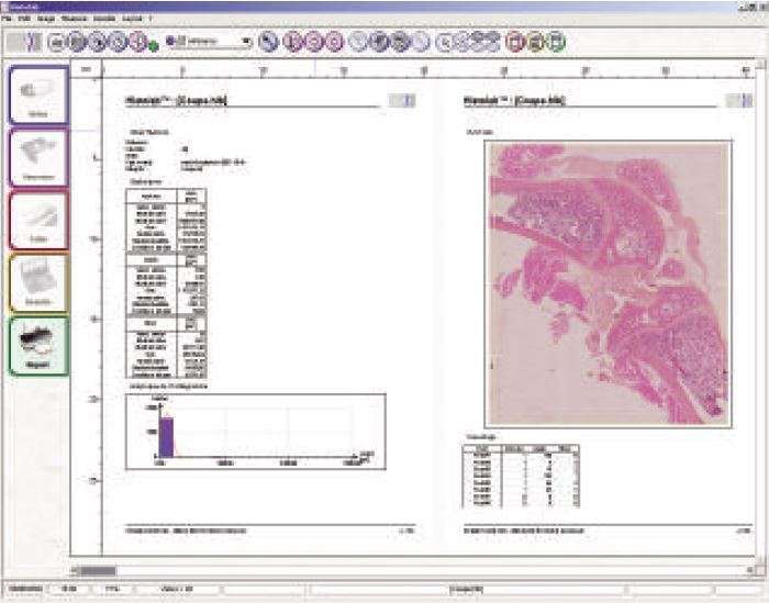 HistoLab Image Analysis Software for Fully Automatic Feature Size, Sha