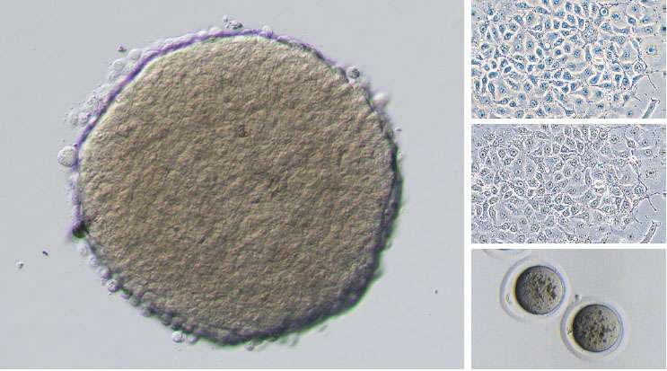 Nikon Eclipse Ts2 Inverted Microscope
