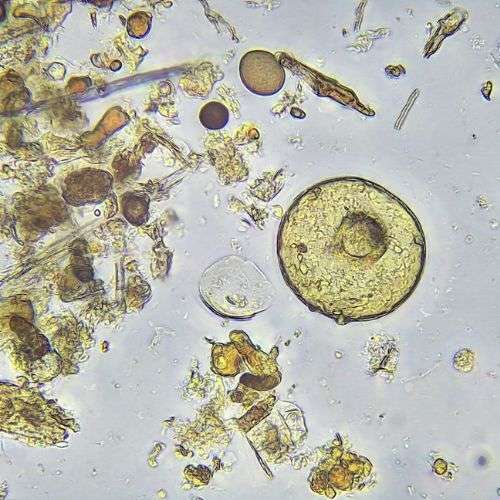 Arcella Amoeba