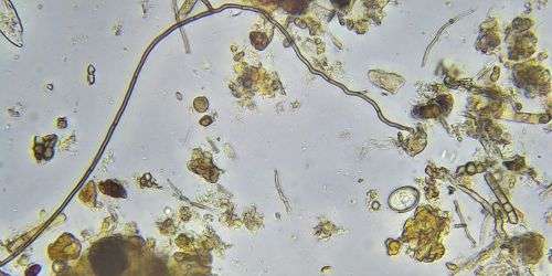 Fungal hyphae testate amoeba